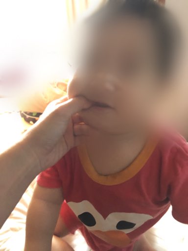 赤ちゃんが噛み付く際、指をスライドさせている写真